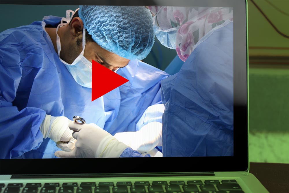 Associations Between Video Evaluations Of Surgical Technique And