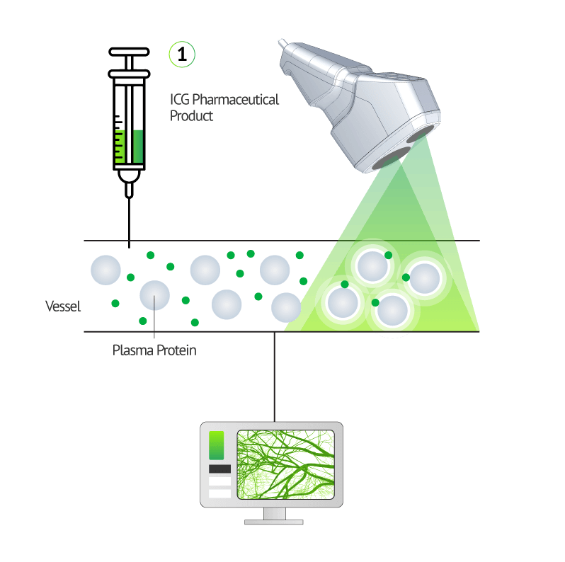 ICG pharmaceutical product injection