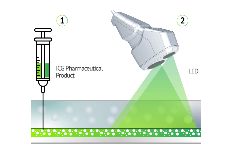 ICG pharmaceutical product visulization