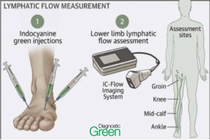 lymphatic flow measurement graphic